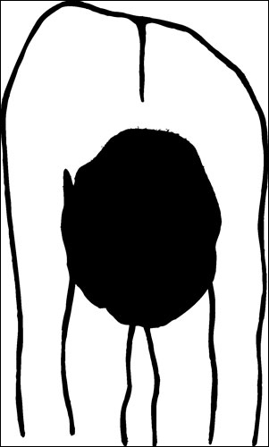Drawing of a person performing the forward bending test, which reveals they have one side of the back higher than the other.
